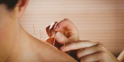 terapija akupunkturom